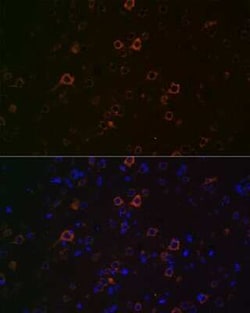 Huntingtin Rabbit anti-Human, Mouse, Rat, Clone: 7B9C8, Novus Biologicals 100 &mu;g | Buy Online | Novus Biologicals | Fisher Scientific