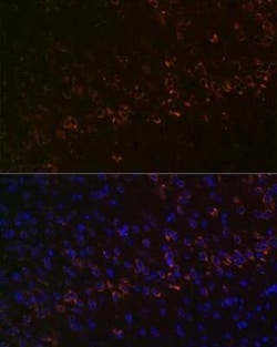 Huntingtin Rabbit anti-Human, Mouse, Rat, Clone: 7B9C8, Novus Biologicals 100 &mu;g | Buy Online | Novus Biologicals | Fisher Scientific