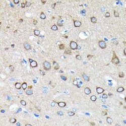 Huntingtin Rabbit anti-Human, Mouse, Rat, Clone: 7B9C8, Novus Biologicals 100 &mu;g | Buy Online | Novus Biologicals | Fisher Scientific