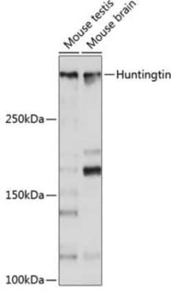 Huntingtin Rabbit anti-Human, Mouse, Rat, Clone: 7B9C8, Novus Biologicals 100 &mu;g | Buy Online | Novus Biologicals | Fisher Scientific