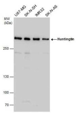 Huntingtin Antibody, Novus Biologicals 100 &mu;g | Buy Online | Novus Biologicals | Fisher Scientific