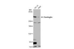 Huntingtin Antibody, Novus Biologicals 100 &mu;g | Buy Online | Novus Biologicals | Fisher Scientific