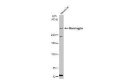 Huntingtin Antibody, Novus Biologicals 100 &mu;g | Buy Online | Novus Biologicals | Fisher Scientific