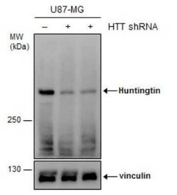 Huntingtin Antibody, Novus Biologicals 100 &mu;g | Buy Online | Novus Biologicals | Fisher Scientific