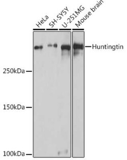 Huntingtin Rabbit anti-Human, Mouse, Rat, Polyclonal, Novus Biologicals 100 &mu;g | Buy Online | Novus Biologicals | Fisher Scientific