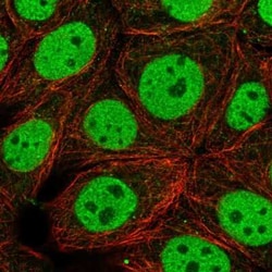 Huntingtin Interacting Protein K Antibody, Novus Biologicals 25 &mu;L,