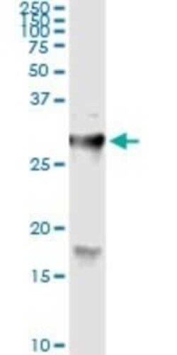 Novus Biologicals Hyaluronidase 1/HYAL1 Antibody (2H7), Novus Biologicals