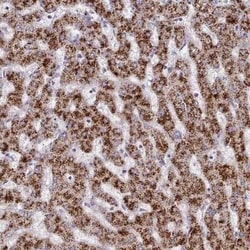 Hydroxyacid Oxidase-1/HAO-1 Antibody, Novus Biologicals 25 &mu;L; Unconjugated:Antibodies,