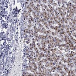 Hydroxyacid Oxidase-1/HAO-1 Rabbit anti-Human, Polyclonal, Novus Biologicals:Antibodies:Primary