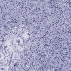 Hydroxyacid Oxidase-1/HAO-1 Rabbit anti-Human, Polyclonal, Novus Biologicals:Antibodies:Primary