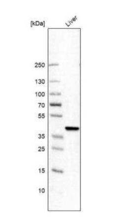 Hydroxyacid Oxidase-1/HAO-1 Antibody, Novus Biologicals 25 &mu;L; Unconjugated:Antibodies,