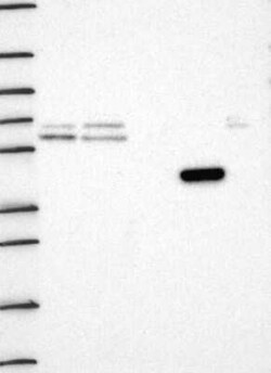 Hydroxyacid Oxidase-1/HAO-1 Rabbit anti-Human, Polyclonal, Novus Biologicals:Antibodies:Primary