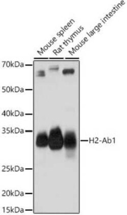 I-Ab Rabbit anti-Human, Mouse, Rat, Polyclonal, Novus Biologicals 20 &mu;g | Buy Online | Bio-Techne | Fisher Scientific