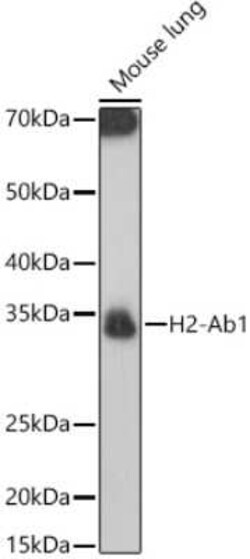 I-Ab Rabbit anti-Human, Mouse, Rat, Polyclonal, Novus Biologicals 20 &mu;g | Buy Online | Bio-Techne | Fisher Scientific