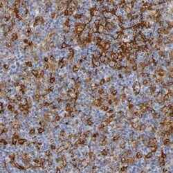 ICAM-1/CD54 Antibody, Novus Biologicals 0.1 mL | Buy Online | Novus Biologicals | Fisher Scientific