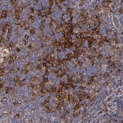 ICAM-1/CD54 Antibody, Novus Biologicals 25 &mu;L | Buy Online | Novus Biologicals | Fisher Scientific