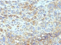 ICAM-1/CD54 Antibody (W-CAM-1 (same as Wehi-CAM-1 or 1H4)), Novus Biologicals:Antibodies:Primary