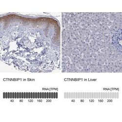 ICAT/CTNNBIP1 Rabbit anti-Human, Polyclonal, Novus Biologicals:Antibodies:Primary