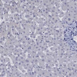 ICAT/CTNNBIP1 Rabbit anti-Human, Polyclonal, Novus Biologicals:Antibodies:Primary