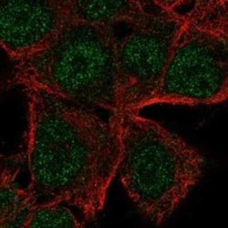 ICB1 Rabbit anti-Human, Polyclonal, Novus Biologicals:Antibodies:Primary