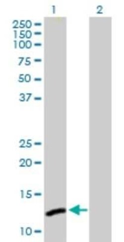 ICB1 Antibody, Novus Biologicals 0.1 mg | Buy Online | Novus Biologicals | Fisher Scientific