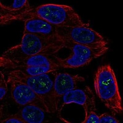 ICK Antibody, Novus Biologicals 25ul; Unconjugated:Antibodies, Polyclonal