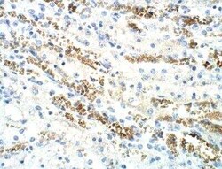 ICMT Antibody, Novus Biologicals 100 &mu;g | Buy Online | Novus Biologicals | Fisher Scientific