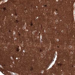 ID1 Mouse anti-Human, Clone: CL11981, Novus Biologicals 100 &mu;g; Unconjugated:Antibodies,