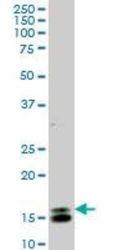 ID1 Antibody (1F7), Novus Biologicals 0.1 mg | Buy Online | Novus Biologicals | Fisher Scientific