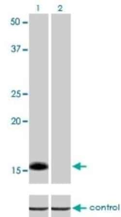 ID1 Antibody (1F7), Novus Biologicals 0.1 mg | Buy Online | Novus Biologicals | Fisher Scientific