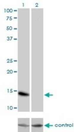 ID3 Antibody (4G1), Novus Biologicals 0.1 mg | Buy Online | Novus Biologicals | Fisher Scientific