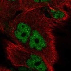 ID4 Rabbit anti-Human, Polyclonal, Novus Biologicals 25 &mu;g; Unconjugated:Antibodies,