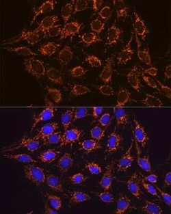 IDH2 Rabbit anti-Human, Mouse, Rat, Clone: 8C3D4, Novus Biologicals 100 &mu;g | Buy Online | Bio-Techne | Fisher Scientific