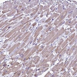 IDH3A Antibody, Novus Biologicals:Antibodies:Primary Antibodies
