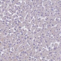 IDH3A Antibody, Novus Biologicals:Antibodies:Primary Antibodies