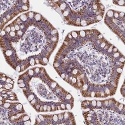 IDH3A Antibody, Novus Biologicals:Antibodies:Primary Antibodies