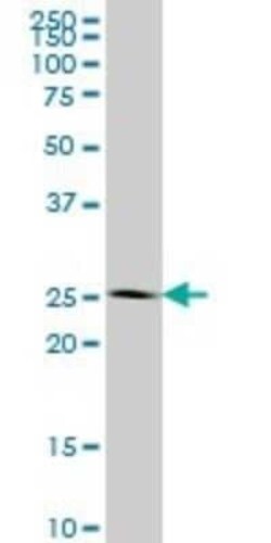IDI1 Antibody (6G10), Novus Biologicals 0.1 mg | Buy Online | Novus Biologicals | Fisher Scientific