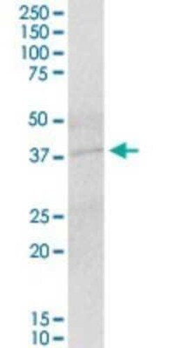 IER5 Antibody, Novus Biologicals 0.05 mg, Unconjugated:Antibodies, Polyclonal