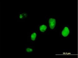 IFI16 Antibody, Novus Biologicals 0.05 mg | Buy Online | Novus Biologicals | Fisher Scientific