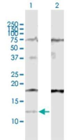 IFI27 Antibody, Novus Biologicals 0.1 mg | Buy Online | Novus Biologicals | Fisher Scientific