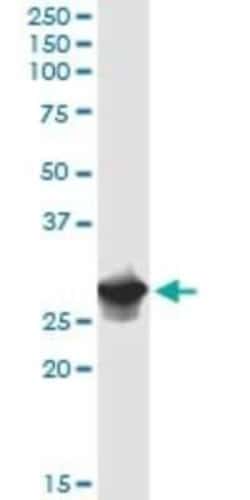 IFI35 Antibody, Novus Biologicals 0.1 mg | Buy Online | Novus Biologicals | Fisher Scientific