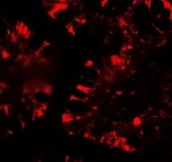 IFIT1 Antibody - BSA Free, Novus Biologicals 0.1 mg; Unconjugated:Antibodies,