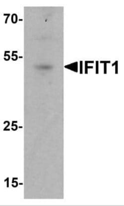 IFIT1 Antibody - BSA Free, Novus Biologicals 0.1 mg; Unconjugated:Antibodies,