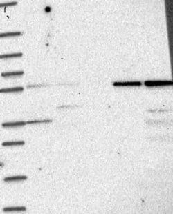 IFIT1 Rabbit anti-Human, Polyclonal, Novus Biologicals:Antibodies:Primary