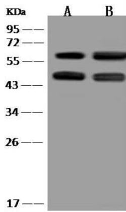 IFIT3 Antibody, Novus Biologicals 100 &mu;g; Unconjugated:Antibodies, Polyclonal