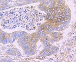 IFITM3/Fragilis Rabbit anti-Human, Mouse, Clone: JU73-02, Novus Biologicals