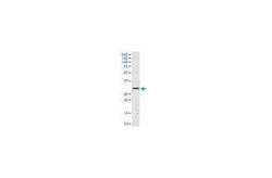 IFN-alpha 2 Antibody (N27), Novus Biologicals 100 &mu;g | Buy Online | Novus Biologicals | Fisher Scientific