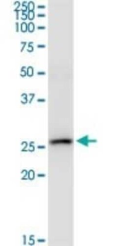 IFN-alpha 2 Antibody (2C10), Novus Biologicals 0.1 mg | Buy Online | Novus Biologicals | Fisher Scientific