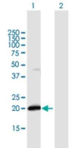 IFN-alpha F/IFNA21 Antibody, Novus Biologicals 0.05 mg | Buy Online | Novus Biologicals | Fisher Scientific