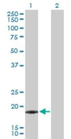 IFN-alpha F/IFNA21 Antibody, Novus Biologicals 0.1 mg | Buy Online | Novus Biologicals | Fisher Scientific